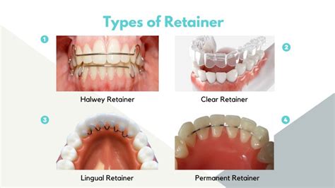 retainer meaning in tagalog